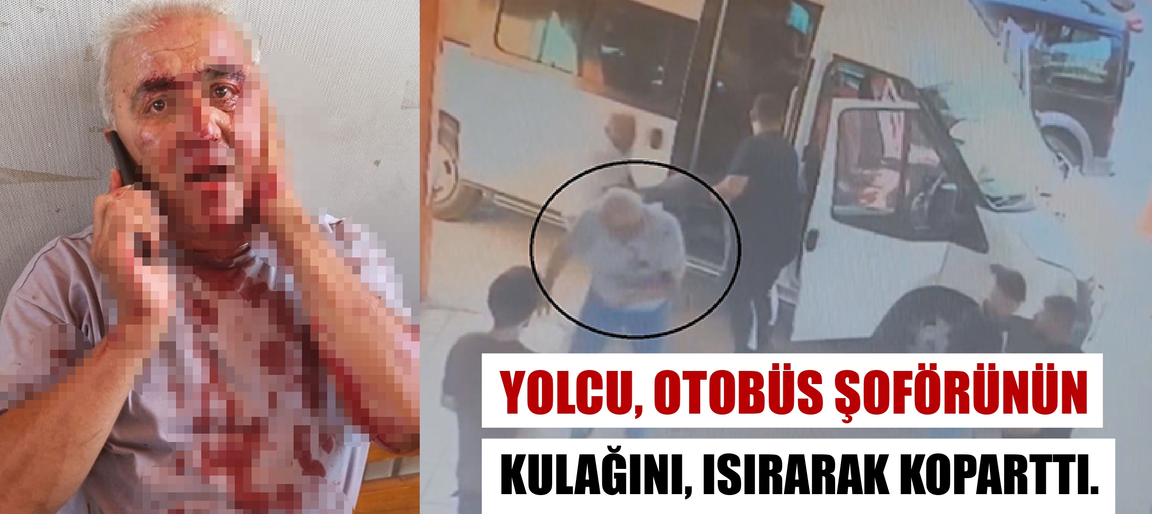 Yolcu, minibüs şoförünün kulağını ısırarak koparttı